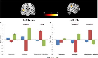 Adult Attachment Affects Neural Response to Preference-Inferring in Ambiguous Scenarios: Evidence From an fMRI Study